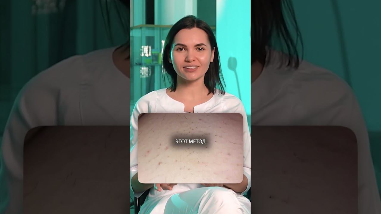Прежде чем использовать эпилятор, посмотрите это видео! #косметология #эпиляция #волосы #красота