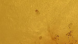 Луковый клещ. Как выглядит под увеличением и без него.. Onion tick. What it looks with magnificatio