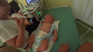 ЭХОКАРДИОСКОПИЯ (узи сердца) ребёнку в 3 месяца