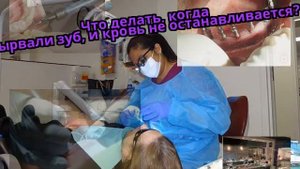 Что делать, когда вырвали зуб, и кровь не останавливается?