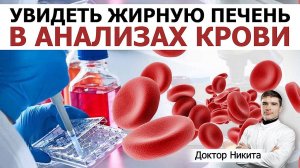 Ожирение печени: Анализы крови при неалкогольном стеатозе. Ферменты печени: АЛТ, АСТ и другие.
