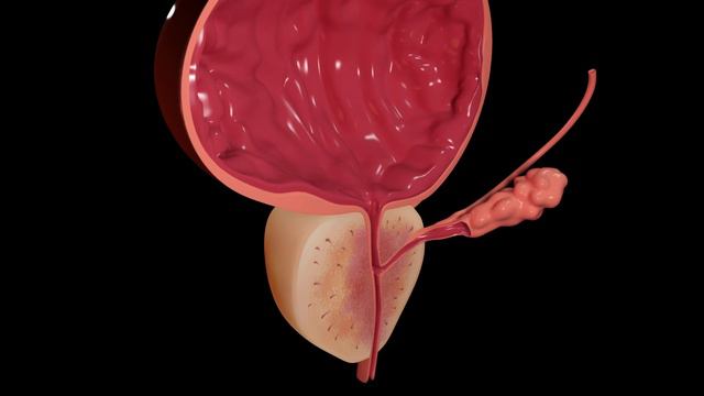 Bovard Euro Pharmaceutical dan Libiprost !!! смотреть онлайн