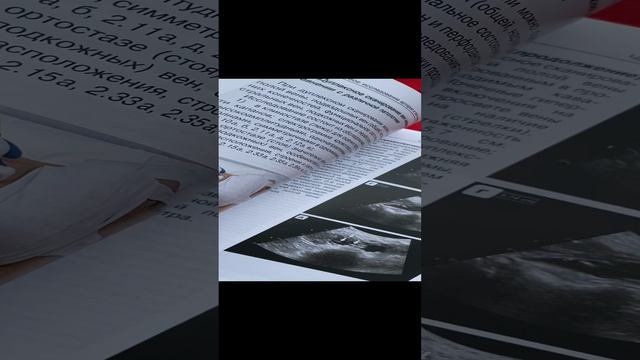 Ультразвуковое исследование при заболеваниях артерий и вен нижних конечностей. Учеб Учебное пособие.