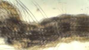 Anopheles  larvae