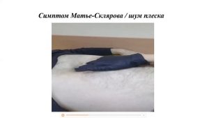 Острая кишечная непроходимость. Симптом Матье-Склярова (шум плеска).