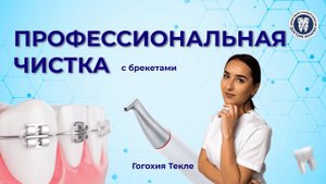 Профессиональная гигиена с брекетами