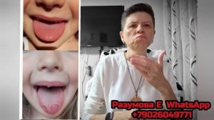 Пятна на языке.