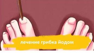 Использование йода от Грибка Ногтей на ногах! Народные рецепты
