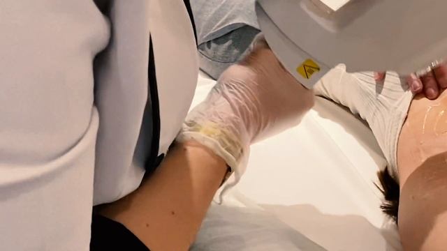 TOUT SUR L'EPILATION DEFINITIVE A LUMIERE PULSEE смотреть онлайн