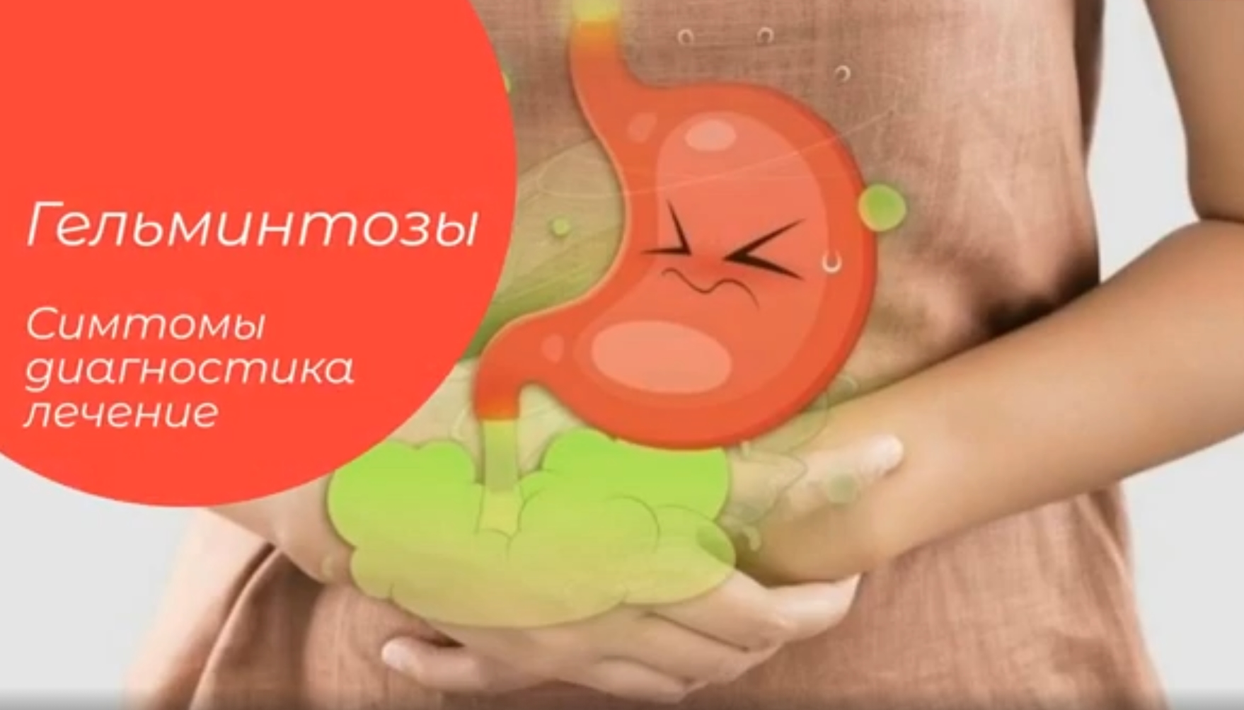 Гельминтозы. Симптомы. Диагностика. ЛЕЧЕНИЕ. смотреть онлайн