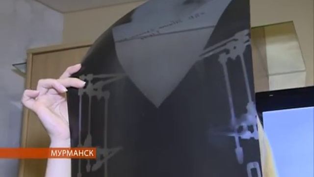 Маленькому мурманчанину с редким заболеванием требуется наша помощь смотреть онлайн