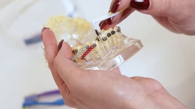 КАК ЧИСТИТЬ БРЕКЕТЫ? ЧЕМ ЧИСТИТЬ БРЕКЕТЫ? ГИГИЕНА? смотреть онлайн