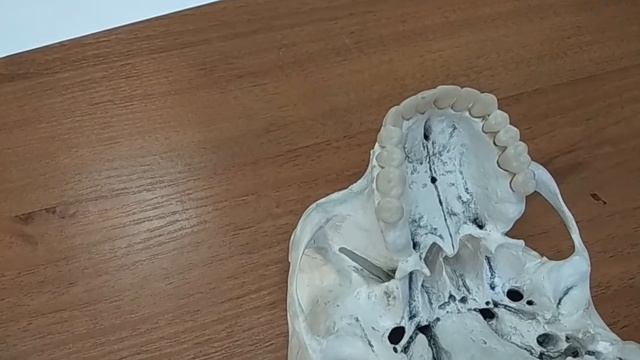 НАРУЖНОЕ ОСНОВАНИЕ ЧЕРЕПА