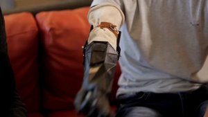 Бионические протезы MBionics