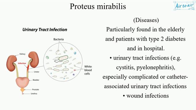 Proteus mirabilis смотреть онлайн