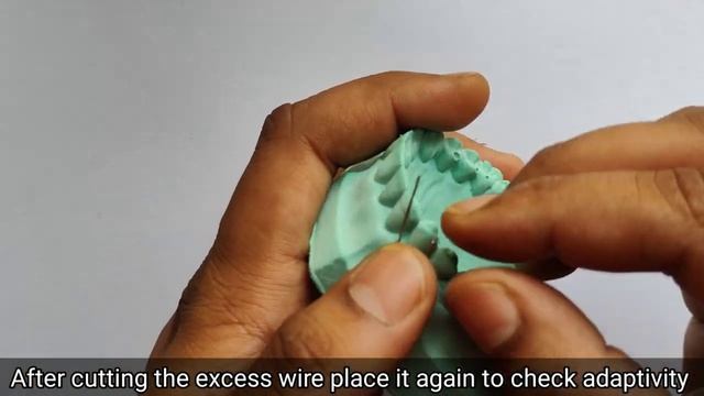 U-Loop Canine Retractor Fabrication Stepwise within 8 minutes #uloopcanineretractor смотреть онлайн