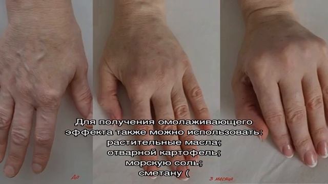 Омоложение рук