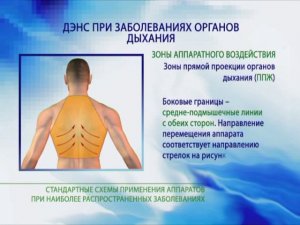 ДЭНАС аппараты при заболеваниях органов дыхания