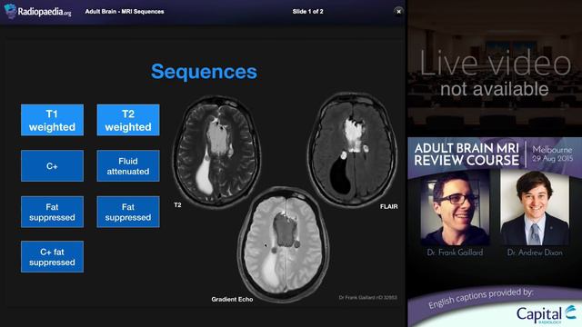 MRI Brain Sequences - radiology video tutorial
