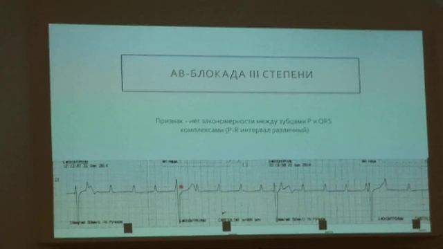 вет.мед AB-блокада ЭКГ смотреть онлайн