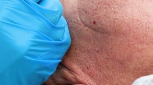 Механическая чистка лица