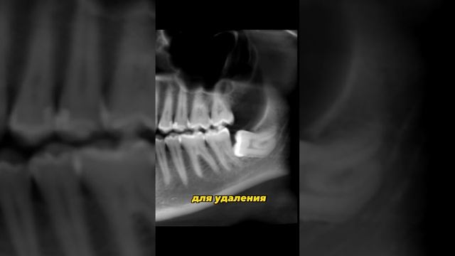 Вернулась в Россию после 2 лет во Франции ?