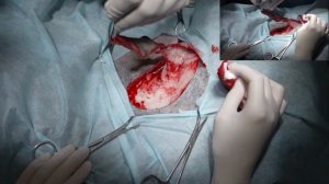 Удаляем мастоцитому у собаки