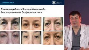 Невероятные результаты Холодной Плазмы ТДМЕДСИ