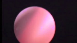 Риноскопия