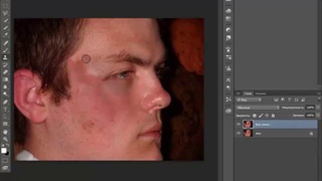 Урок фотошопа — Как убрать шрамы и рубцы на лице в фотошопе смотреть онлайн