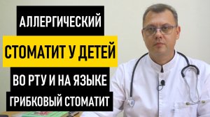 Аллергический Стоматит у Детей. Грибковый стоматит на языке у ребенка и новорожденных