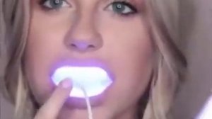 Домашнее Отбеливание Brilliant Smile