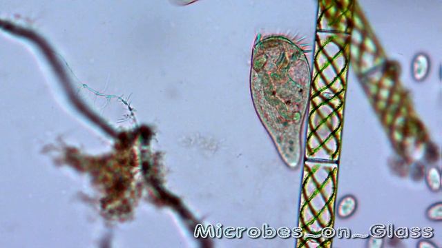 ИНФУЗОРИЯ БУРСАРИЯ (BURSARIA TRUNCATELLA)