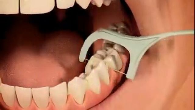 Чистка зубов смотреть онлайн