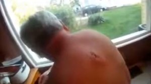 выдавливание огромного чирия