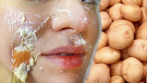 КАРТОФЕЛЬНАЯ МАСКА ДЛЯ ЛИЦА  Как бюджетно отбелить кожу и убрать морщины  POLI NA PALME