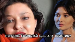 НУРГЮЛЬ ЕШИЛЬЧАЙ СДЕЛАЛА ПЛАСТИКУ. Нургюль Йешильчай. Nurgül Yeşilçay. Турецкие актёры.