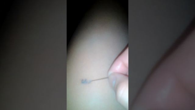 Пытаюсь стереть партак смотреть онлайн