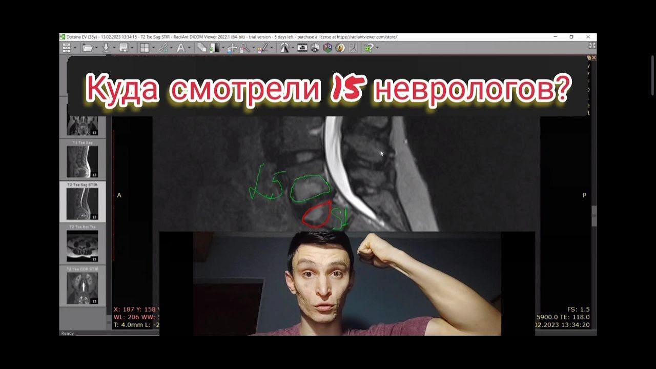 Два года болит поясница! 15 неврологов и один онлайн приём. Винявский Владислав реабилитолог.