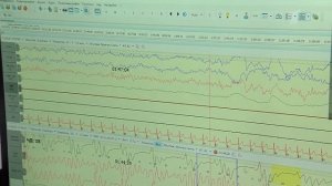 Вред мобильных телефонов для здоровья человека