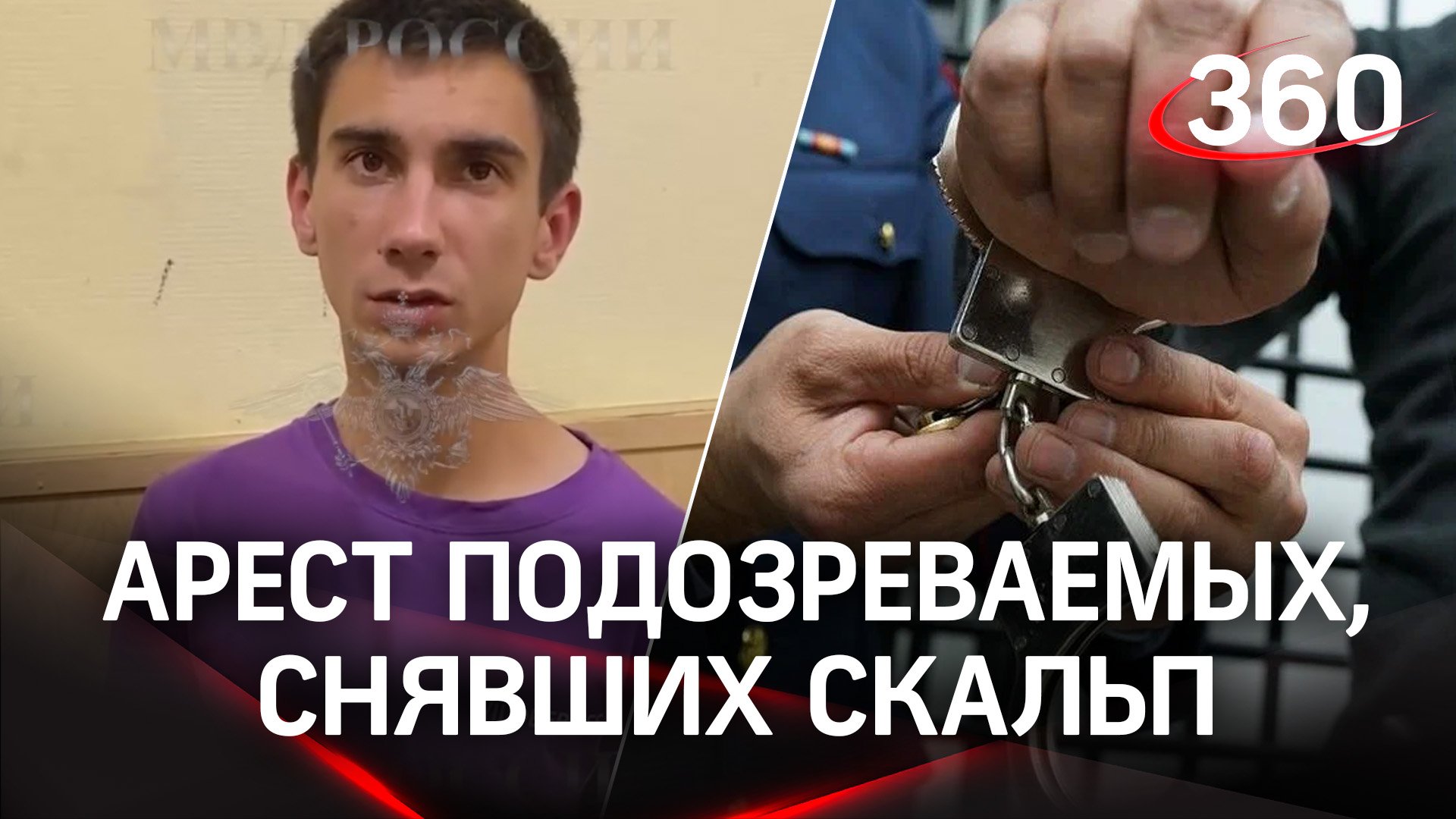Дело о скальпе в Электростали: кадры задержания подозреваемых, первые селфи пострадавшего