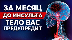 ОПАСНЫЕ предвестники инсульта! / ПЕРВАЯ ПОМОЩЬ при инсульте