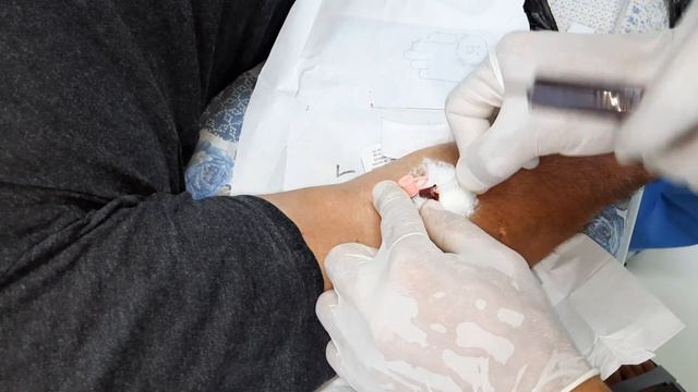 Внутривенная инъекция.Томир ичига инъекция( укол)