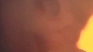 Эмбрион в первый триместр беременности - 2 месяц