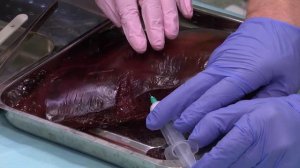 Азбука Здоровья - Революция в лечении геморроя