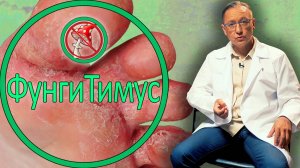 Как БЕЗОПАСНО вылечить грибок на коже и ногтях, научный подход без рецидивов