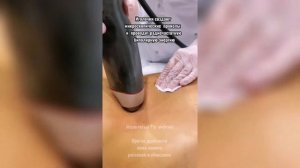 Фракционный игольчатый рф лифтинг зоны живота аппарат Infini