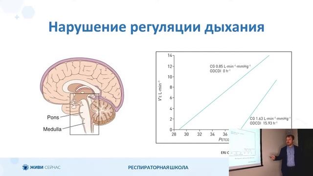3.1 Механизмы развития дыхательной недостаточности при БАС и других нейромышечных заболеваниях