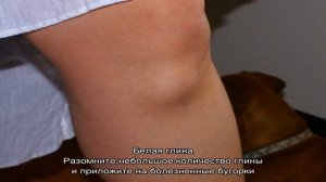Эффективные методы устранения шишек от уколов на ягодицах: что делать, чем рассосать, как убрать г.
