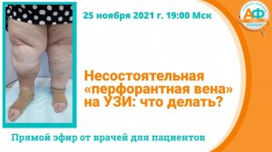 Несостоятельная перфорантная вена на УЗИ что делать